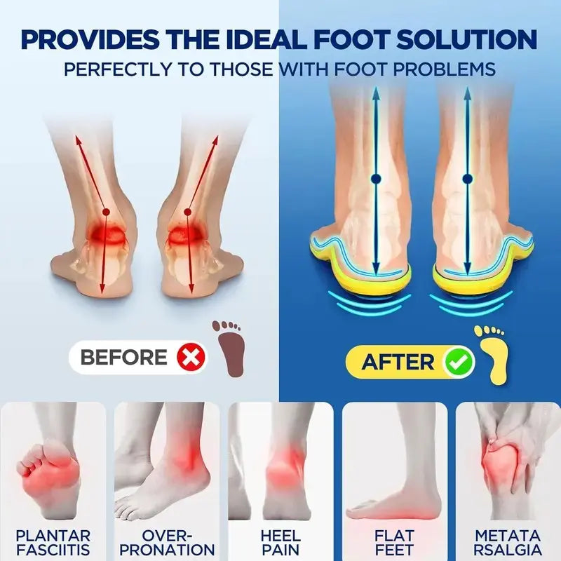 SootheStep Insoles – Instant Heel & Arch Pain Relief for All-Day Comfort