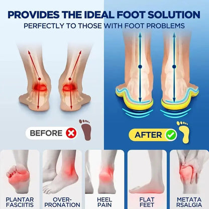 SootheStep Insoles – Instant Heel & Arch Pain Relief for All-Day Comfort