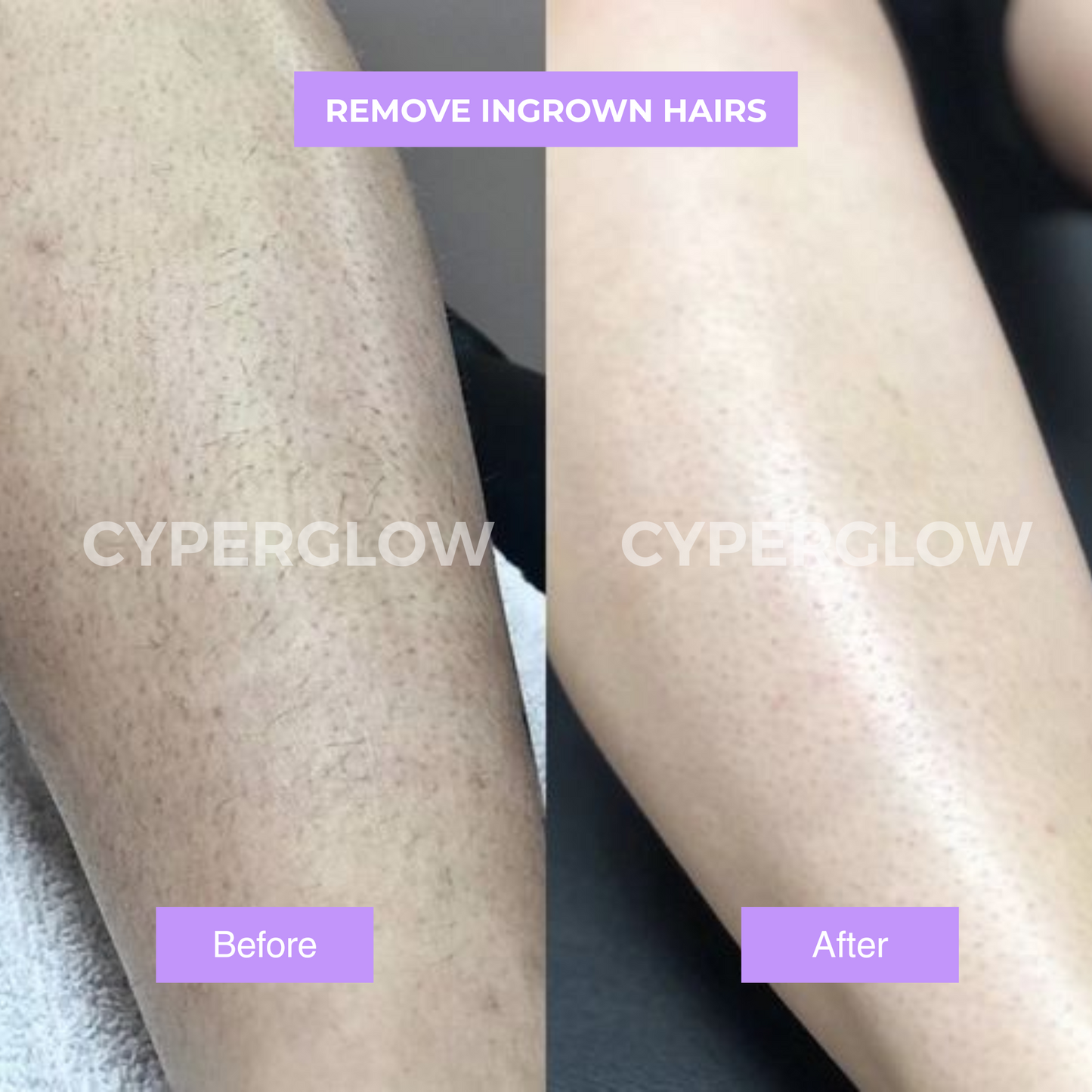 Cyperus Rotundus Skin Oil