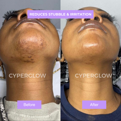 Cyperus Rotundus Skin Oil