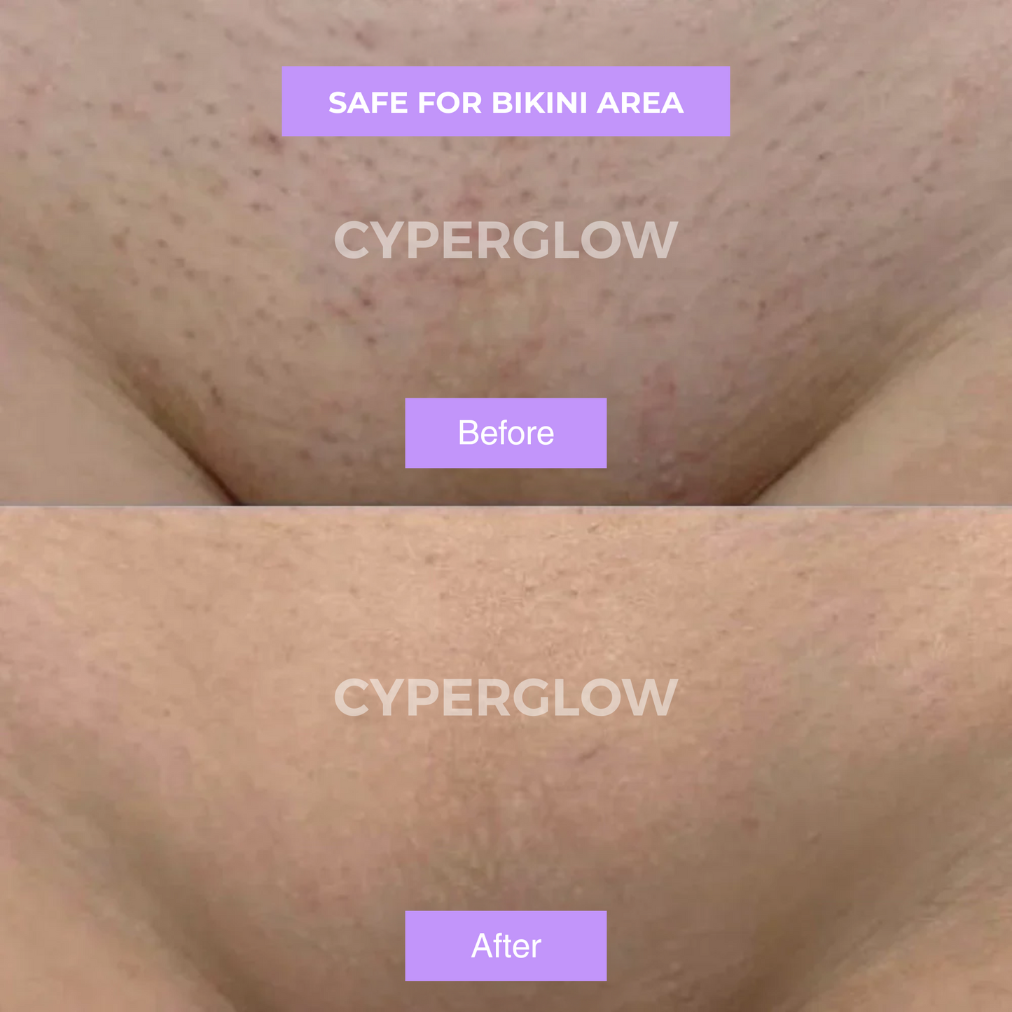 Cyperus Rotundus Skin Oil