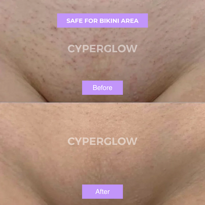 Cyperus Rotundus Skin Oil